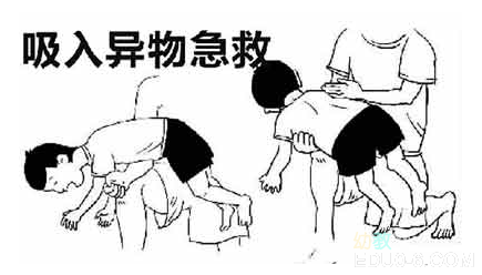 幼师必知的急救常识